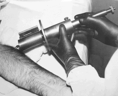 ORINS Syringe Shield
